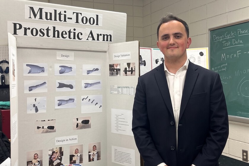 Un estudiante pasó 100 horas frente a una impresora 3D para hacerle una prótesis multifunción a su hermana pequeña
