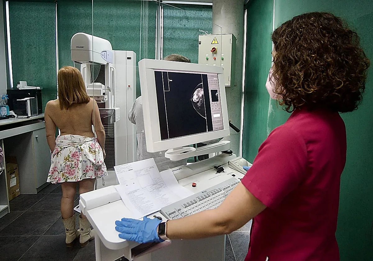 Spain develops calculator to predict likelihood of developing breast cancer over five-year period