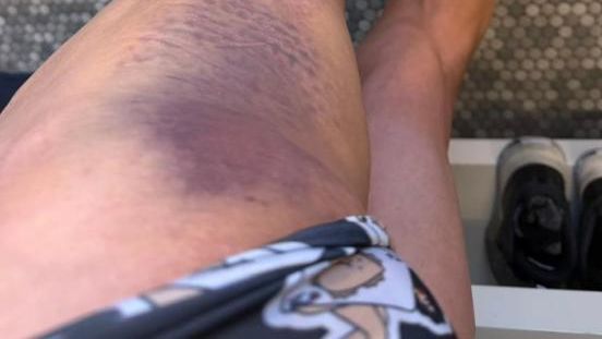 Primoz Roglic, atropellado por un coche en un entrenamiento mientras preparaba La Vuelta