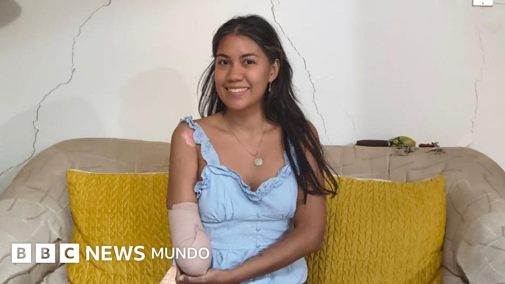 "Haber perdido a mi esposo me duele más que haber perdido mi mano derecha": el testimonio de Nayarit Colmenares, la mujer amputada tras los terremotos en Venezuela