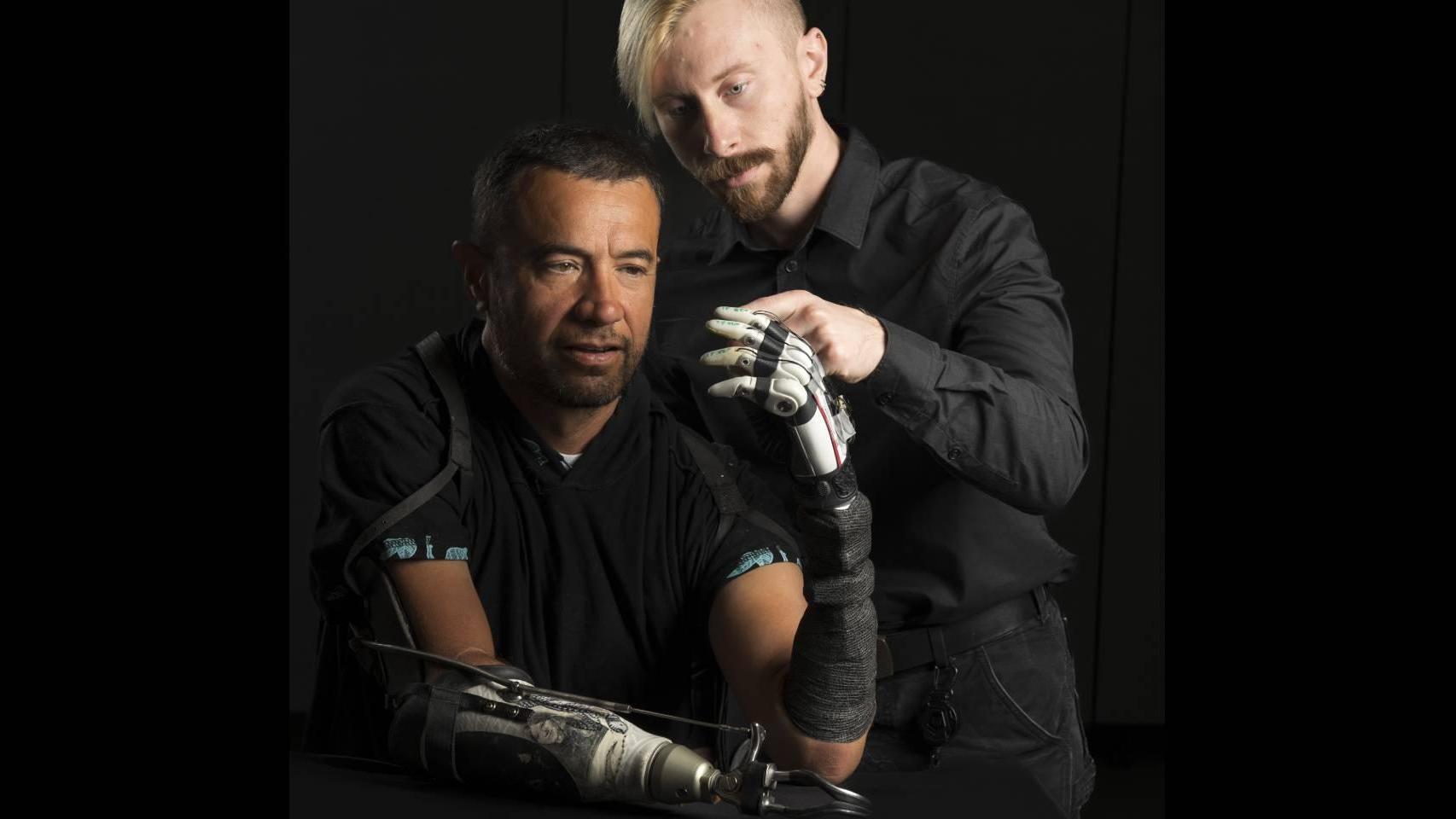 La primera mano biónica con IA incorporada permite recuperar el tacto y los movimientos naturales a personas amputadas