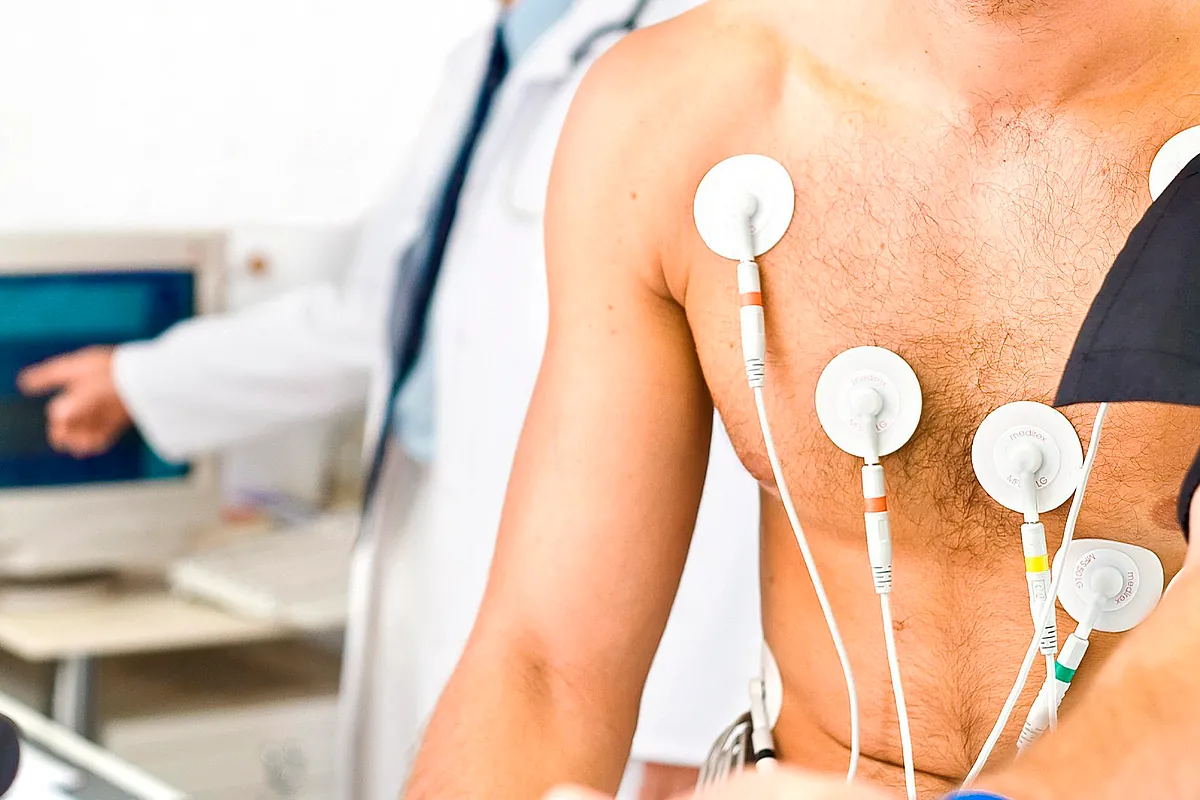 Casi el 60% de los adultos podría padecer aterosclerosis sin saberlo