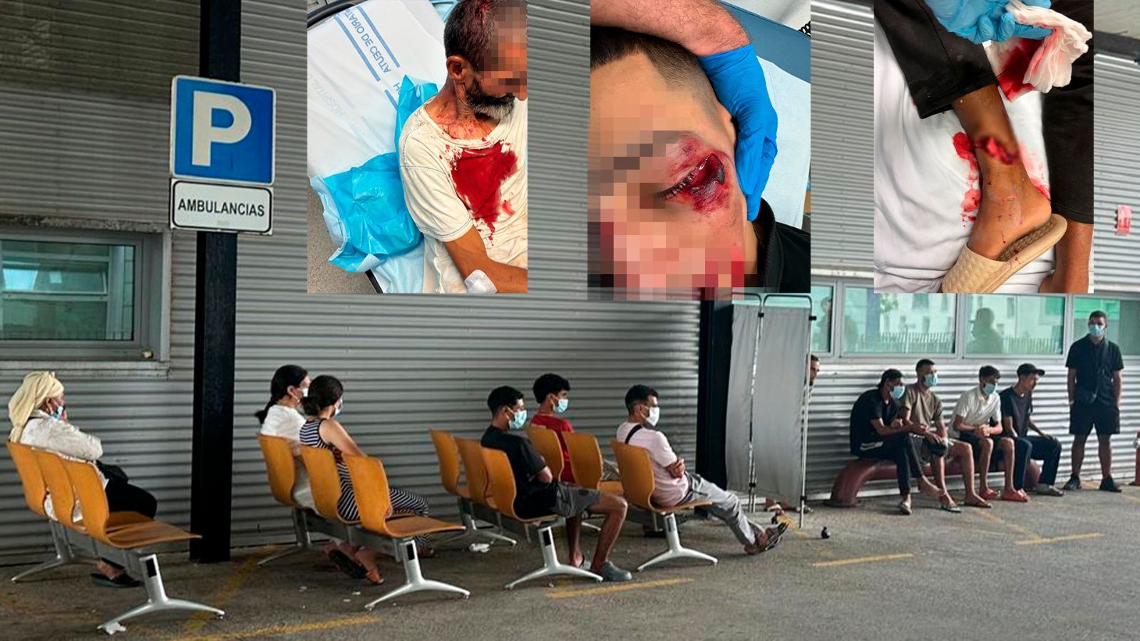 La atención a los migrantes heridos en reyertas satura las Urgencias en Ceuta, con el triple de pacientes que hace un año
