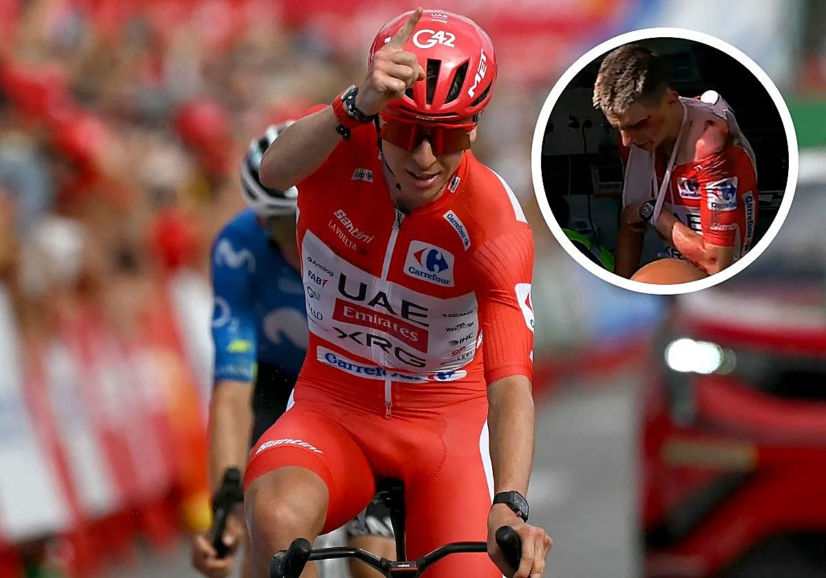Pogacar vuelve a subirse a la bicicleta: «La clavícula y la cabeza están fuertes»