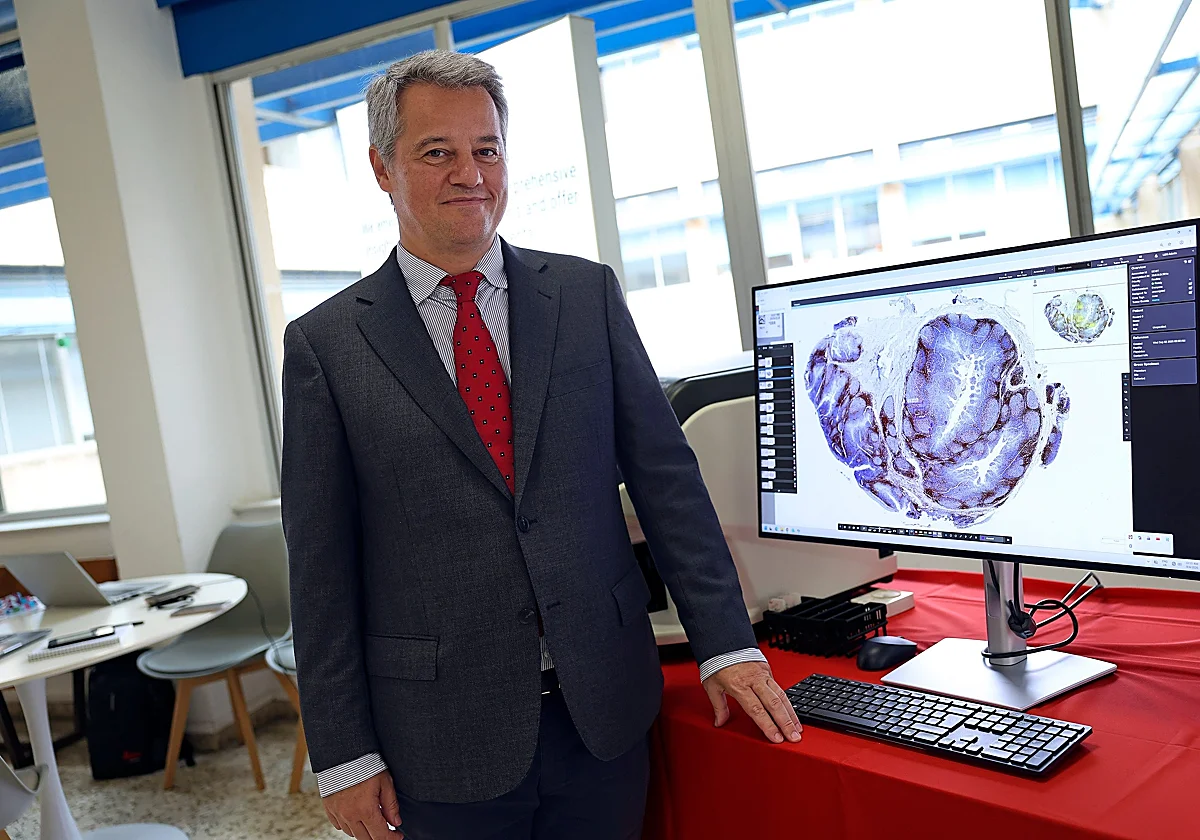 Miguel Alaminos: «Con la piel artificial hemos tenido un 80% de supervivencia en los primeros 15 grandes quemados»