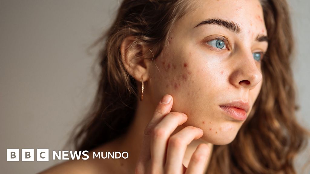 5 consejos de expertos para cuidar la piel adolescente y evitar rutinas que pueden afectarla