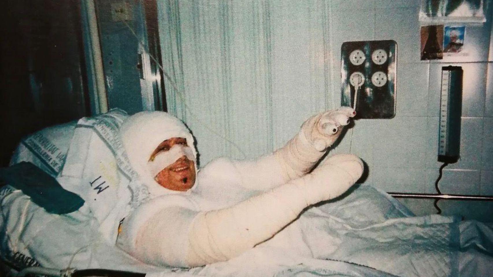 Juan, víctima del accidente de Chinchilla en 2003 en el que perdió 9 dedos: "El tren de Adamuz ha hecho el 'látigo'"