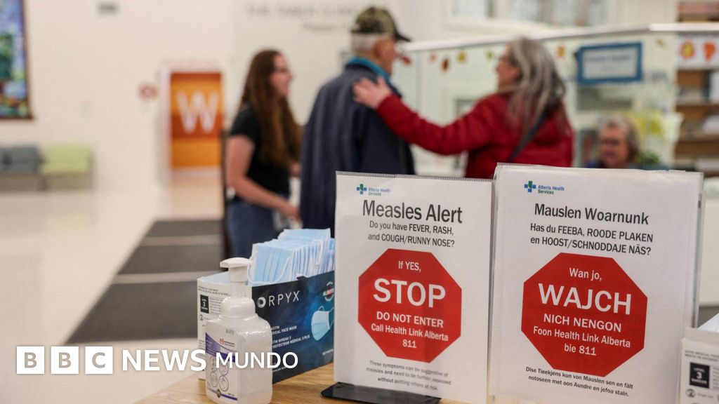 "Es difícil ver a un niño enfermo sabiendo que se puede prevenir": el condado en EE.UU. con el mayor brote de sarampión en décadas
