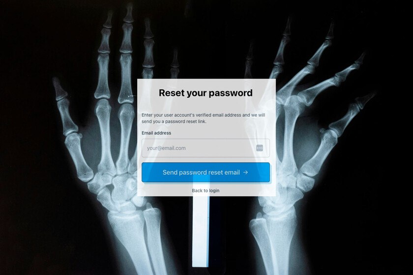 Un hombre se implantó un chip en la mano para hacer trucos de magia: todo bien hasta que se olvidó de la contraseña