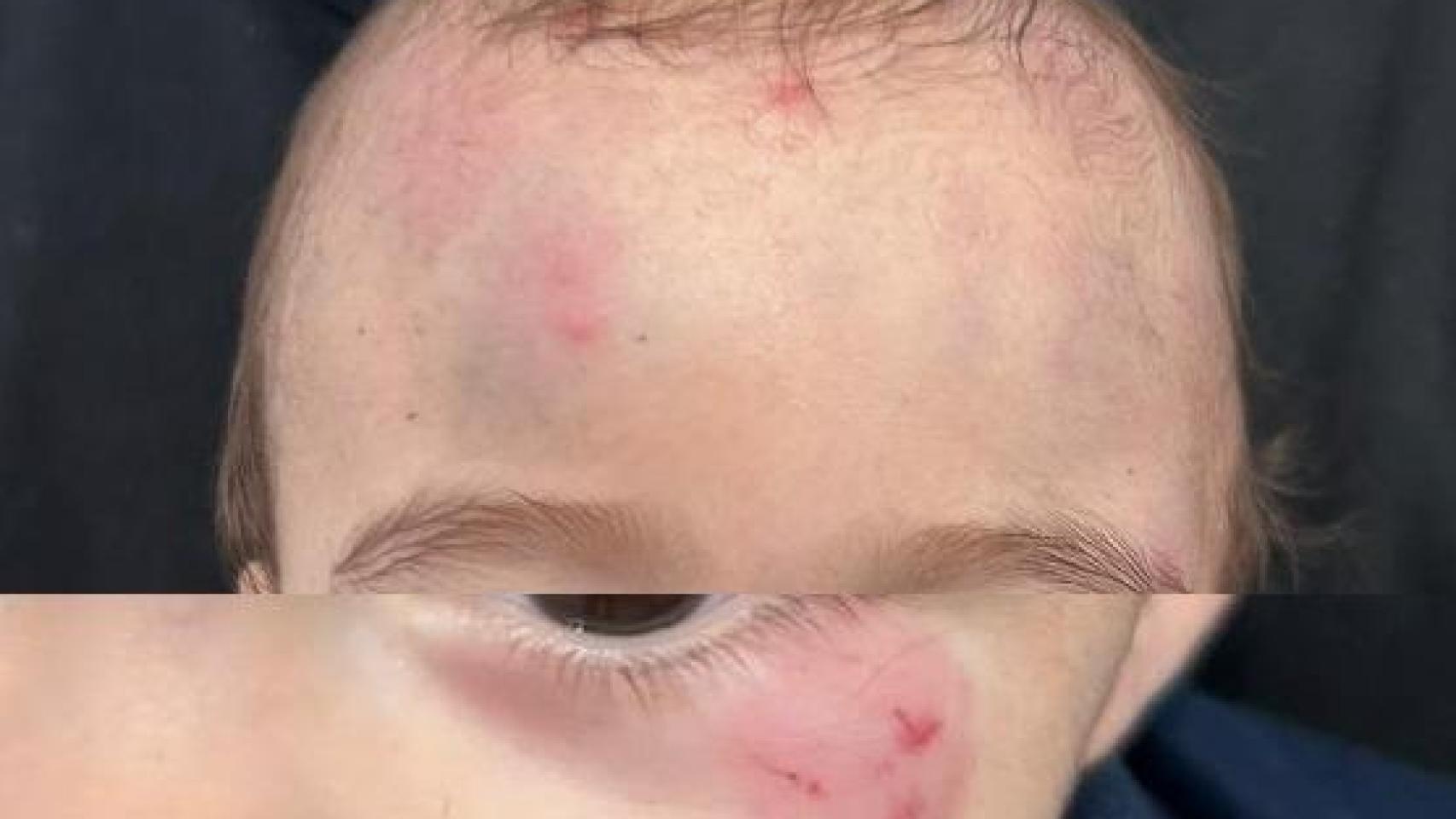 Una pareja de Sevilla denuncia "golpes" a su hijo de nueve meses ejercidos por la profesional de una guardería