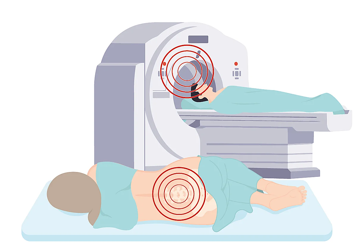 Así son las pruebas para detectar el alzhéimer