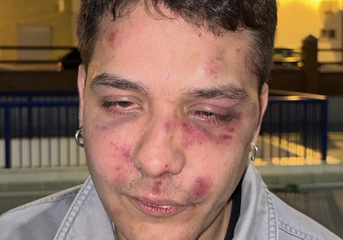 Brutal paliza a un chico al salir de una discoteca de Málaga al grito de «antifascista»