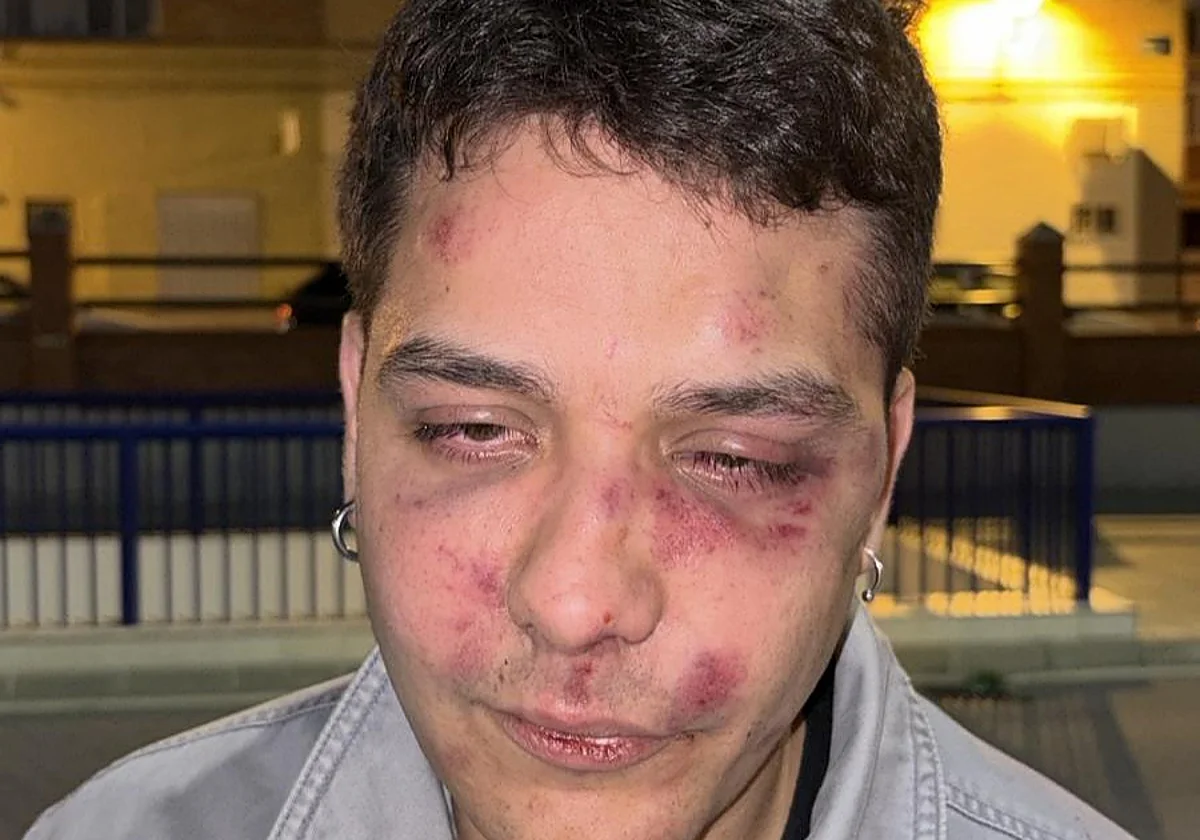 Malaga nightclub assault: young man brutally beaten in 'antifascist' attack