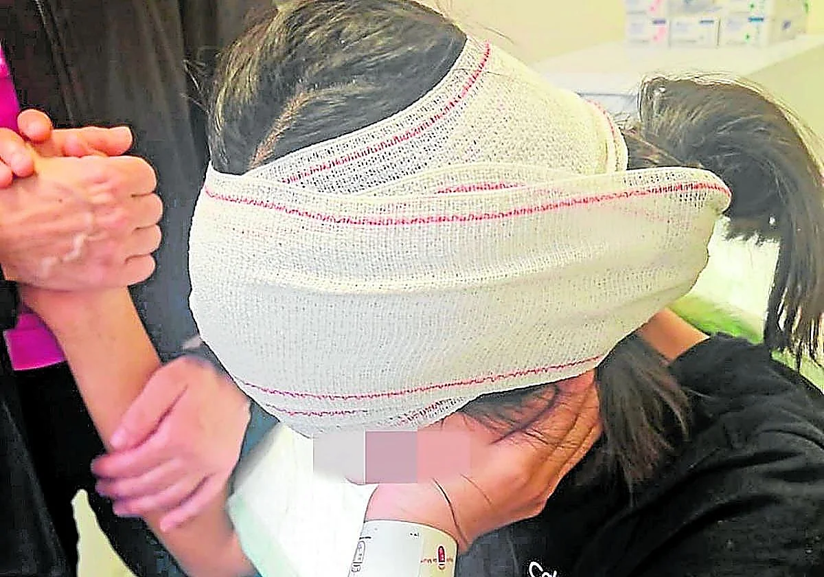 Una menor denuncia que le arrancaron parte de una oreja de un mordisco al salir de clase en Murcia