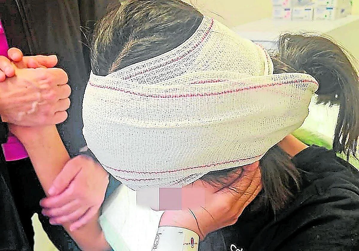 School violence in Spain: Girl fears returning to class after student bites part of her ear off