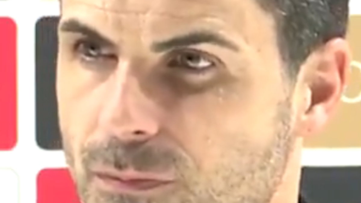Arteta, desconcertado en sala de prensa: "¿Un ojo morado?"
