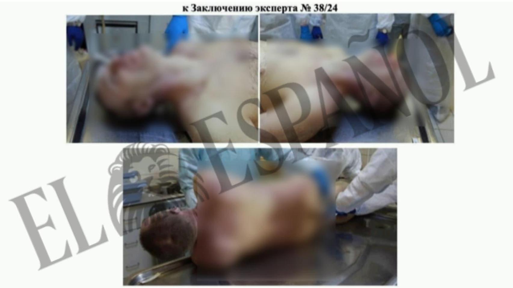 Los 276 folios de la autopsia rusa a Alexei Navalny incluyen sólidos indicios de que sufrió palizas y pudo ser envenenado