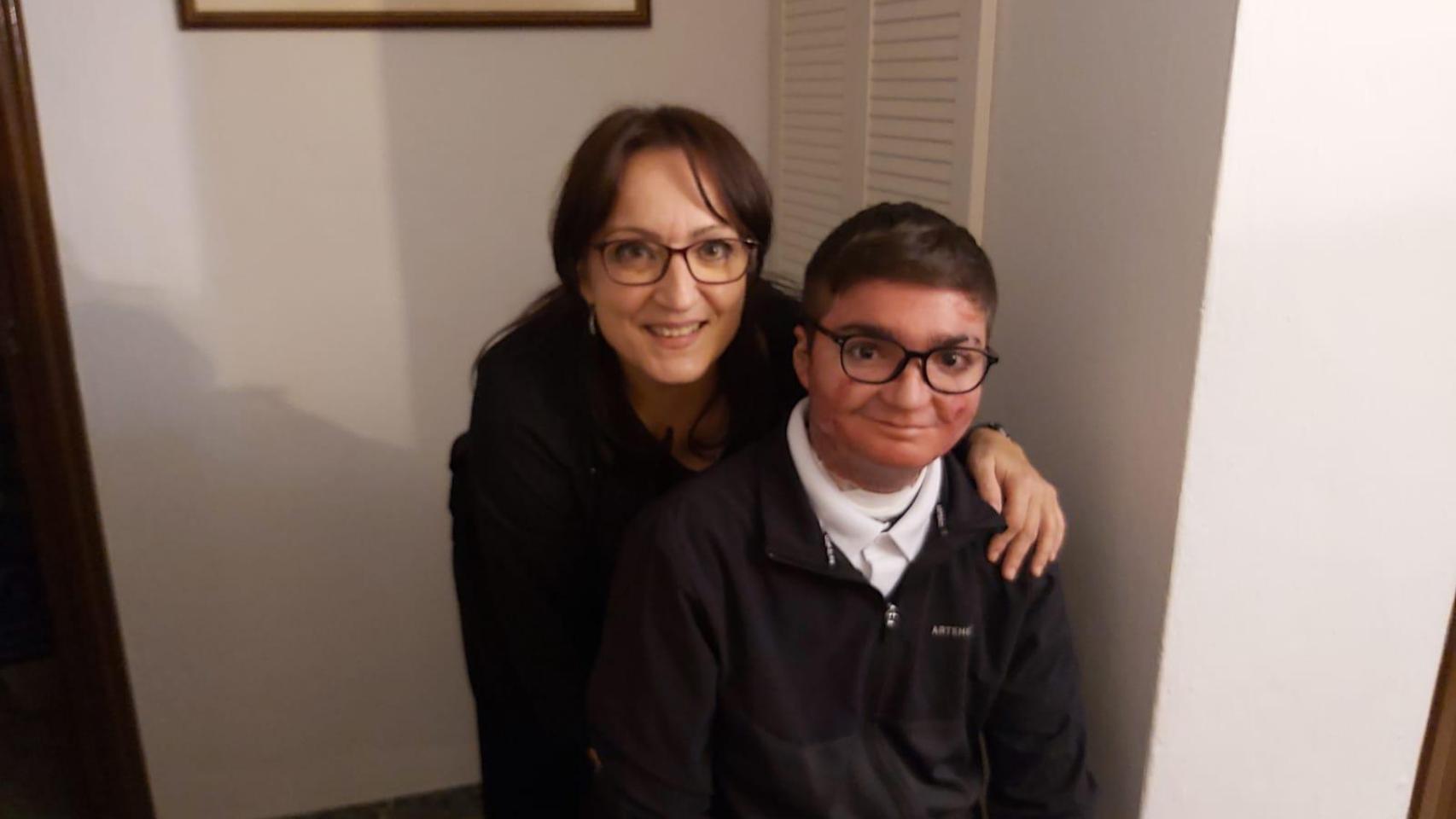 Adrián, el malagueño de 22 años con piel de mariposa al que el Vyjuvek le cambiaría la vida: "Vivimos a contrarreloj"