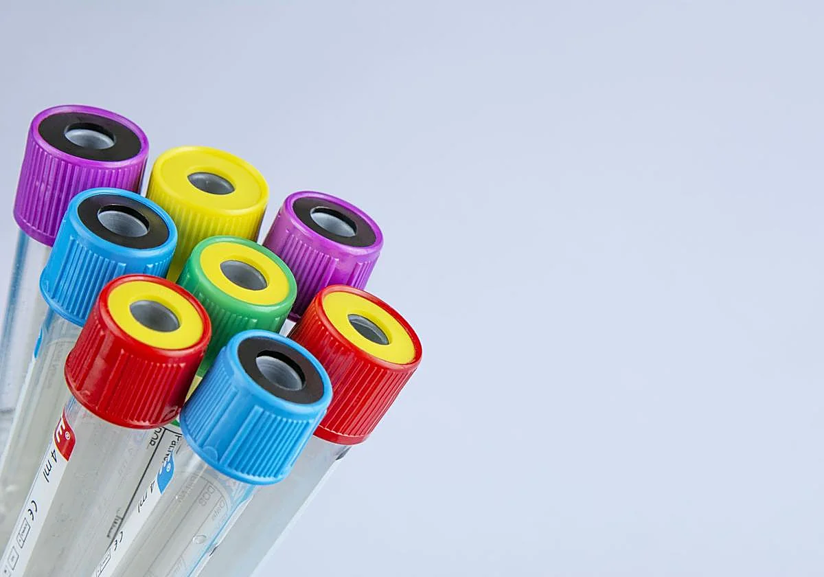 Descubren que el glutatión es un combustible para las células tumorales