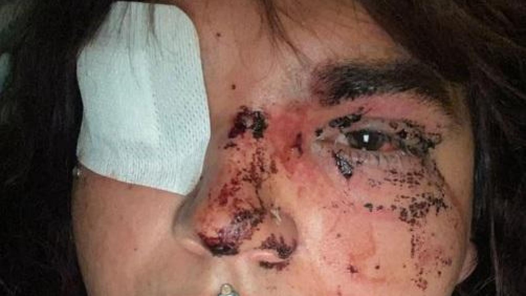 Brutal agresión a Bianca, Miss Trans Zamora, en un pub de La Bañeza: “Travelo de mierda”