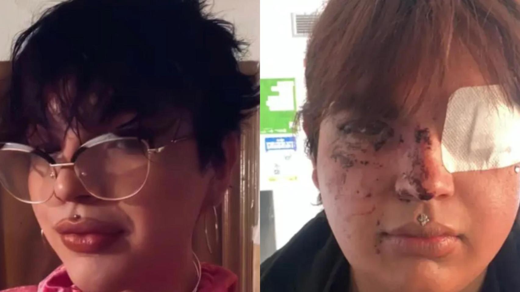 En libertad las cinco detenidas por la agresión a Bianca: no han pasado a disposición judicial ni se ha recibido el atestado