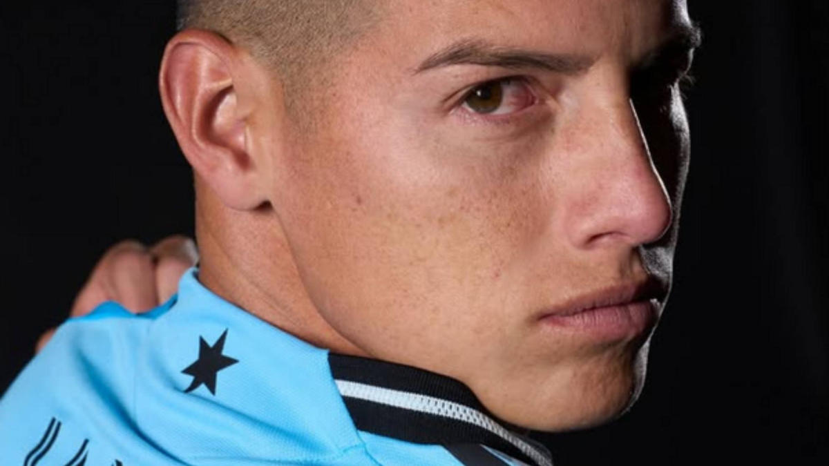 Desmienten que James sufra rabdomiólisis<br>