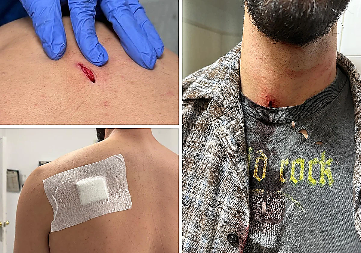 Fuengirola young man reports knife attack by two hooded individuals