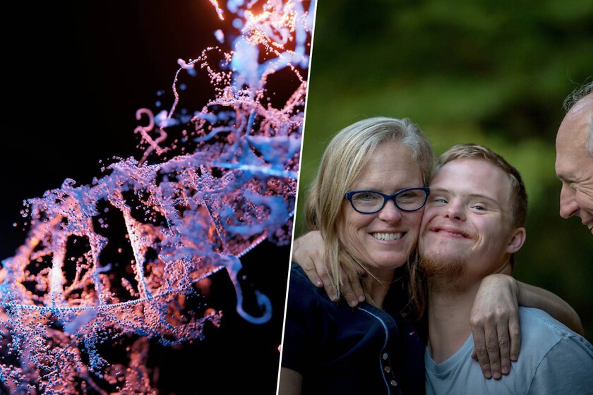 La ciencia ha logrado apagar el cromosoma extra del síndrome de Down. También ha abierto el gran debate ético sobre la edición génica