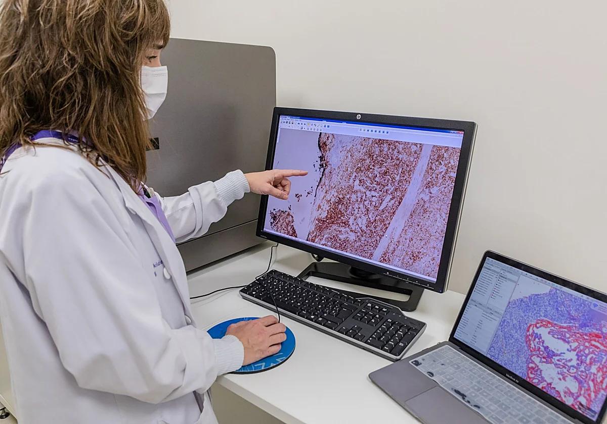 El cáncer de recto aumenta con una mortalidad mayor entre las personas con 20 y 44 años