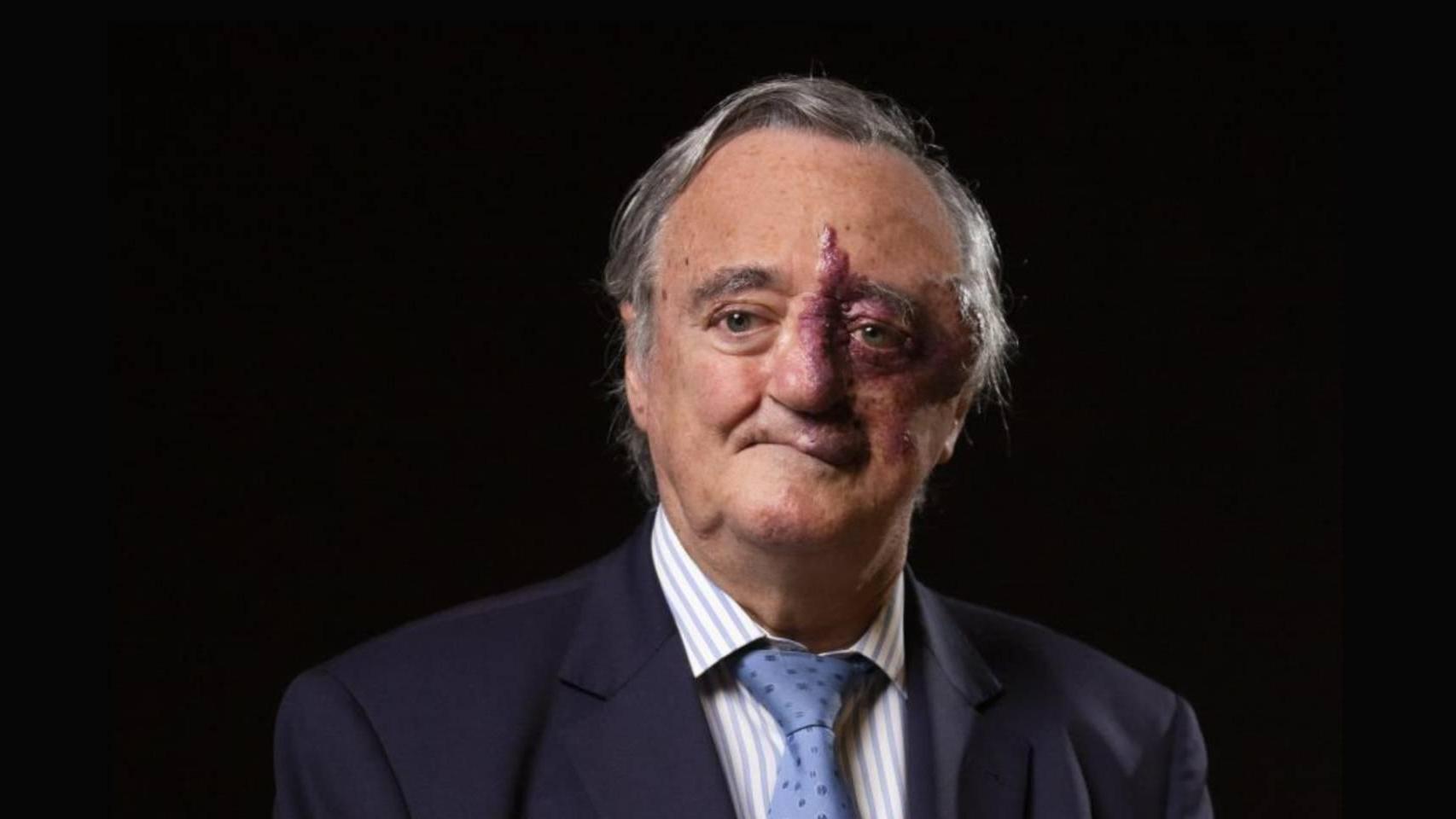 La academia de Ciencias de EEUU retira el estudio sobre el cáncer de páncreas de Barbacid por tapar intereses económicos