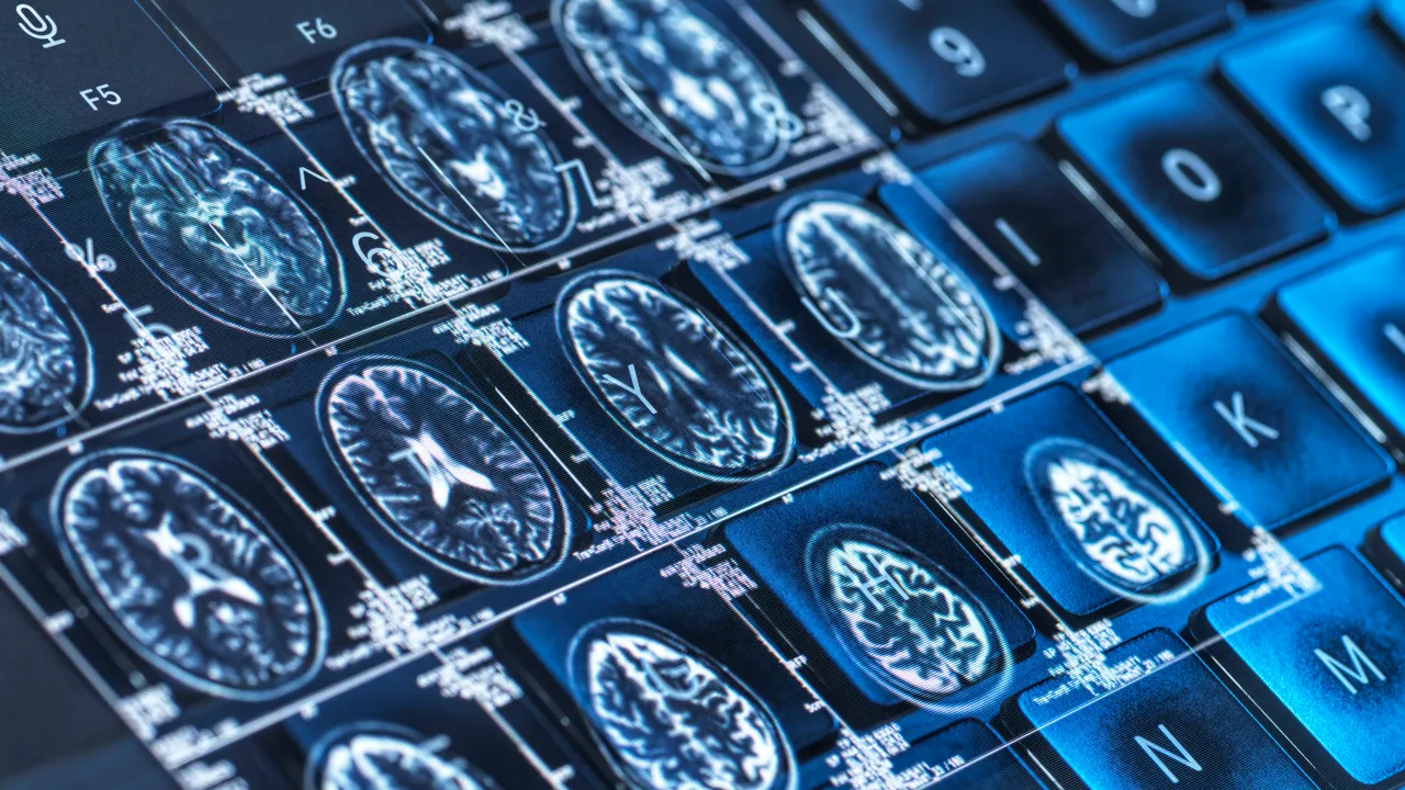 El próximo gran avance contra el Alzheimer requerirá algo más que ciencia