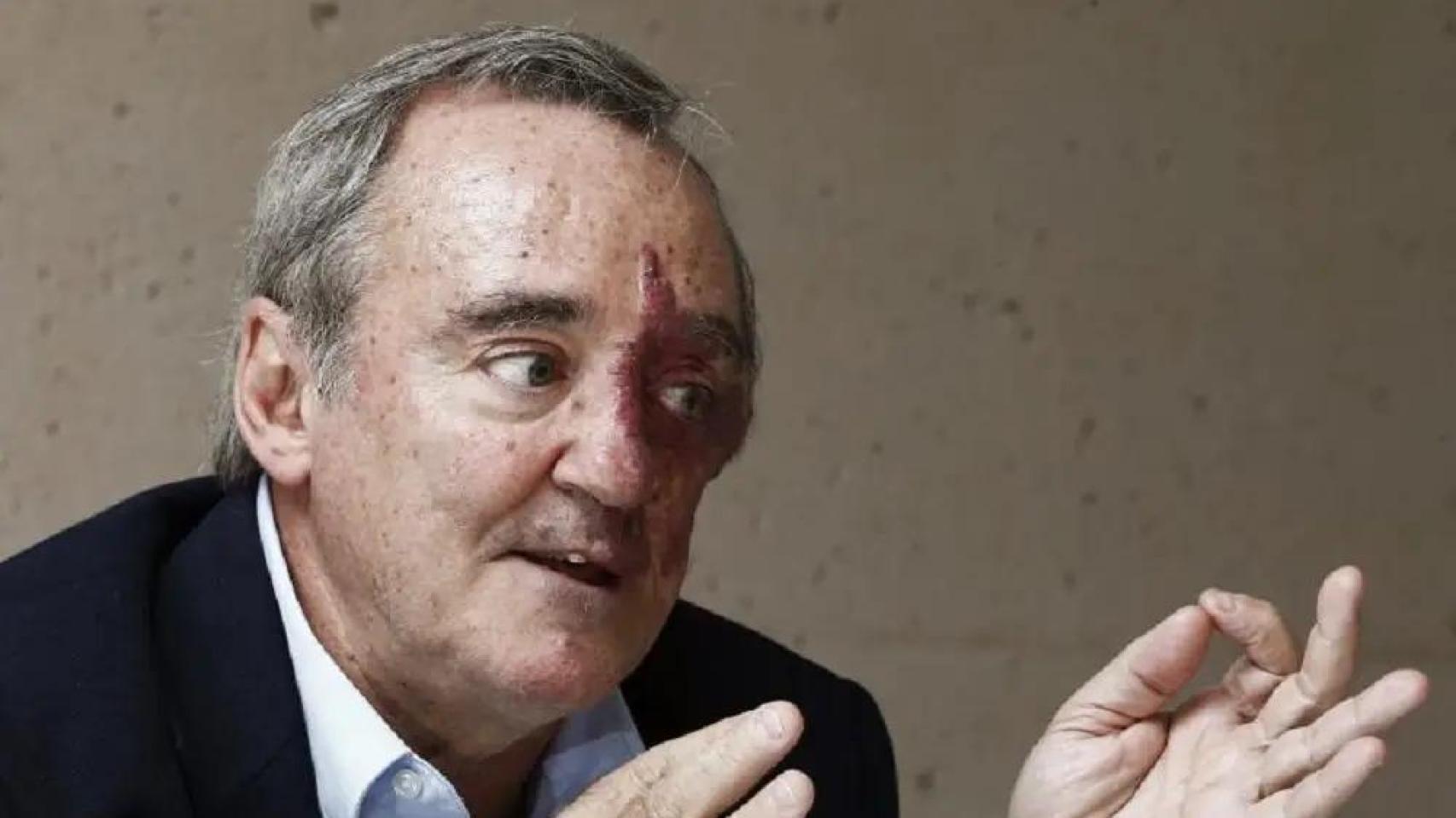 Barbacid renuncia a las acciones de la empresa que podría beneficiarse de su hito sobre el cáncer de páncreas