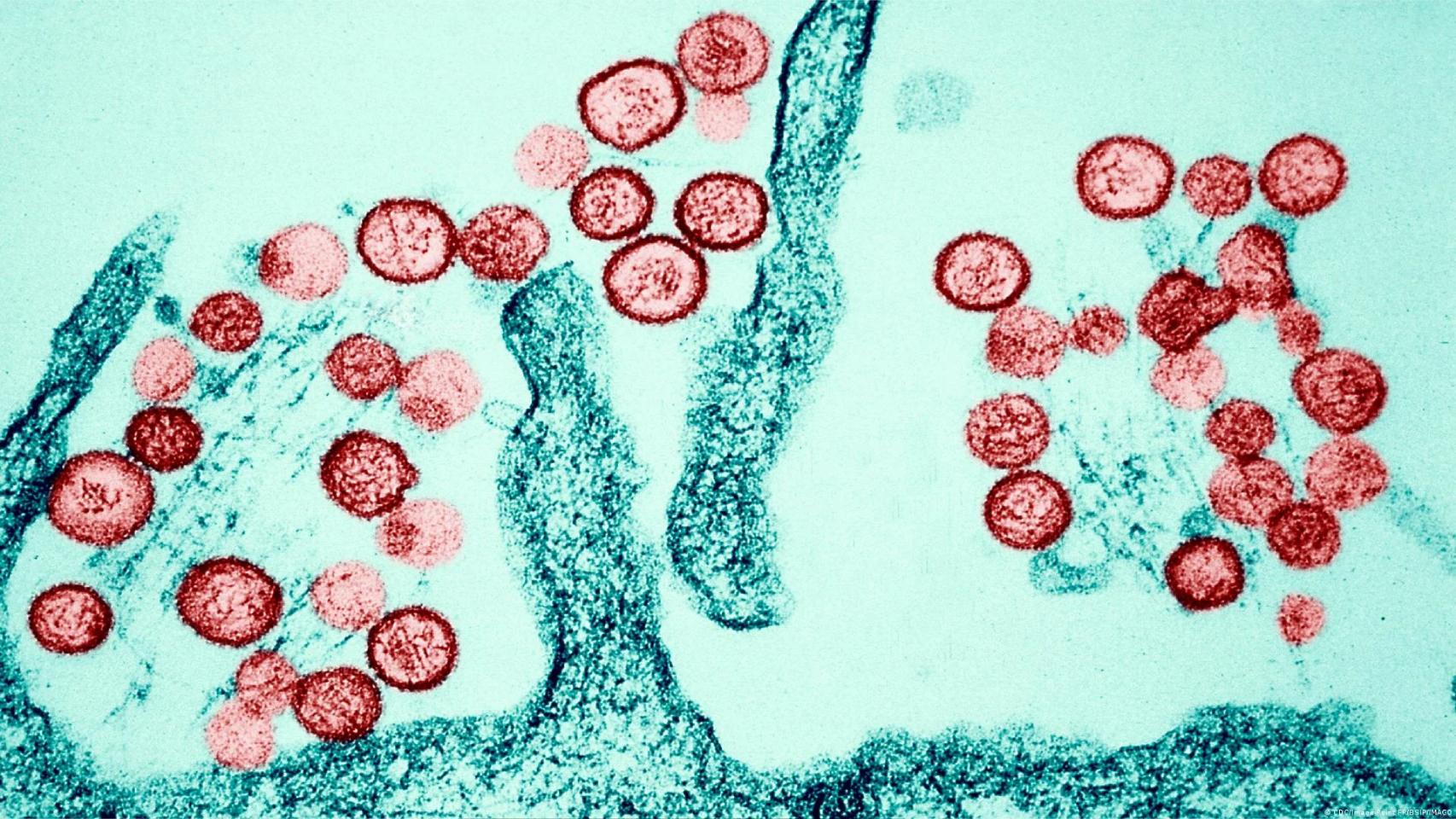 Las claves del virus de los Andes: qué sabemos de la letal cepa que se ha detectado en el crucero con hantavirus