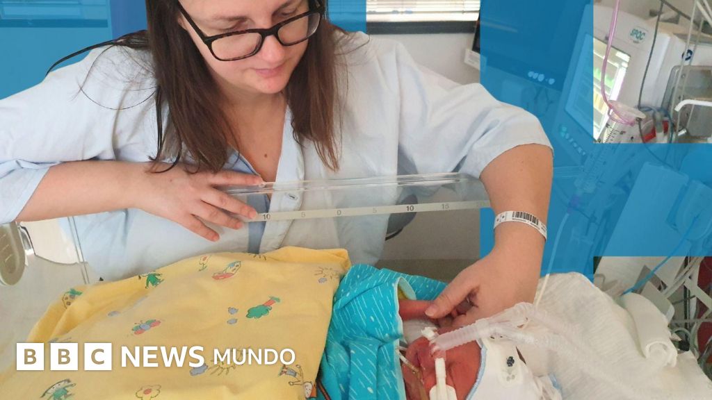 El esperanzador ensayo pionero sobre la preeclampsia, la complicación del embarazo que mata a medio millón de bebés al año