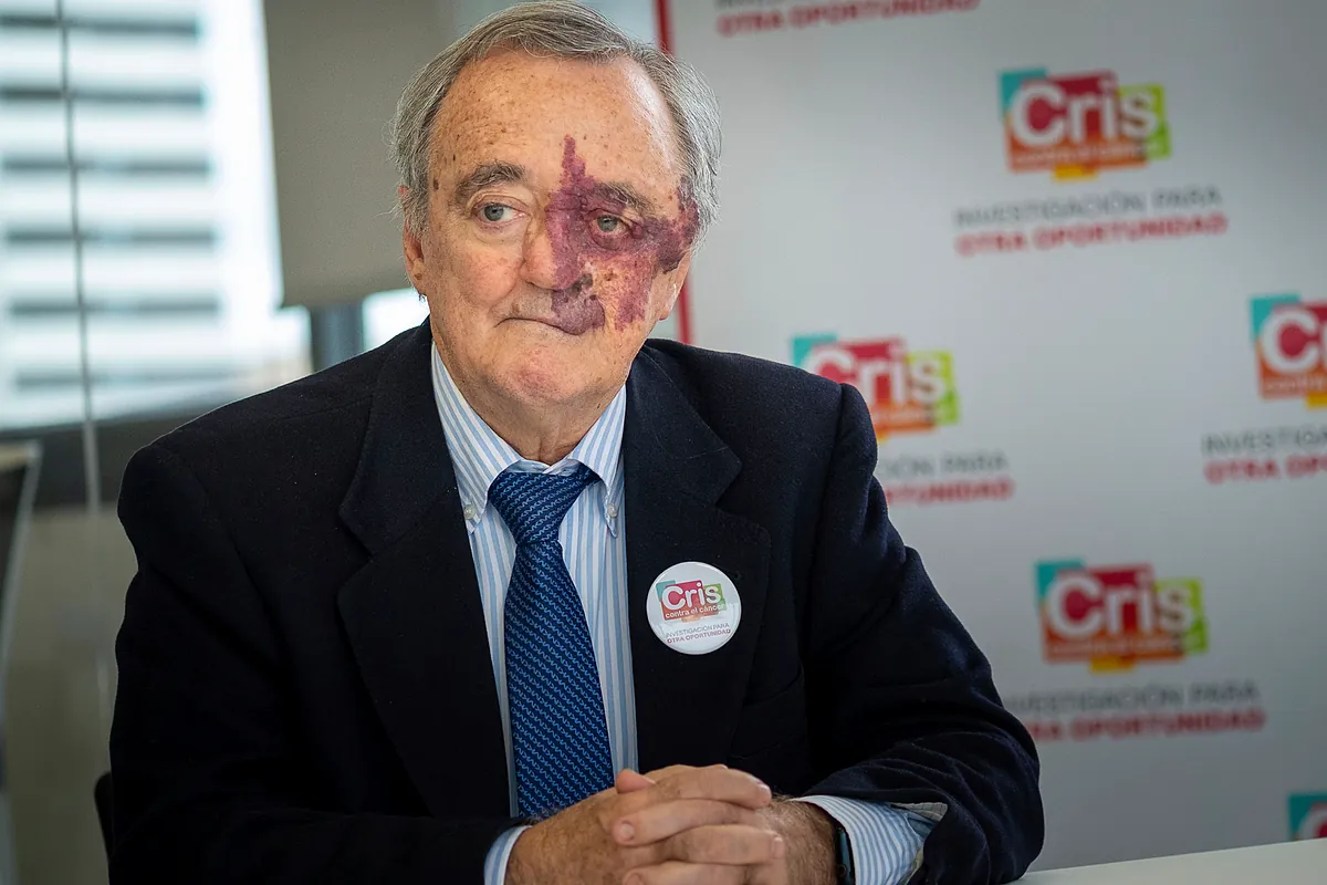 La revista PNAS revalida el estudio del cáncer de páncreas en ratones liderado por Mariano Barbacid