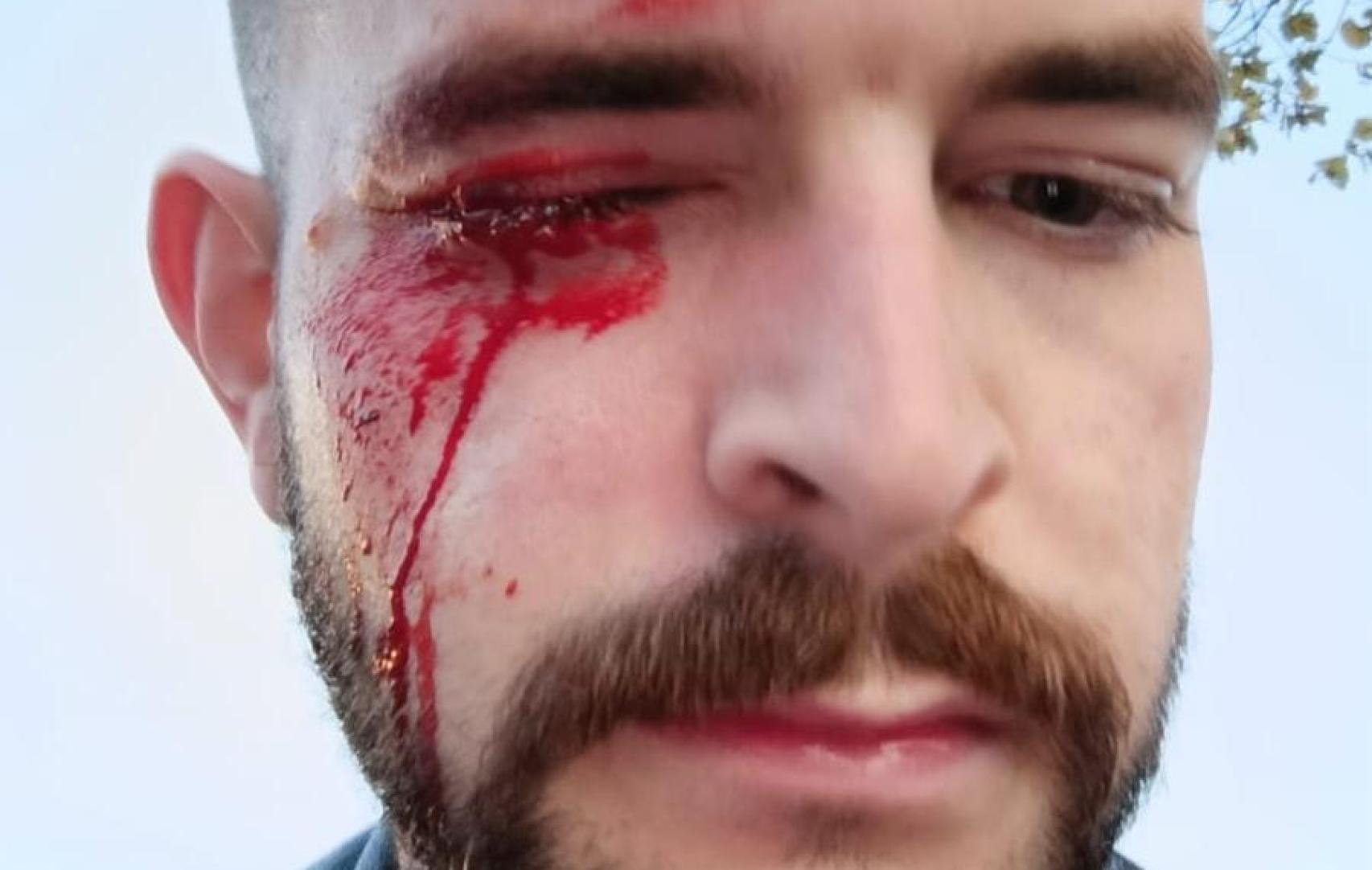 La Policía detiene a 28 personas por los disturbios de Pamplona en los que fue agredido un periodista de El Español